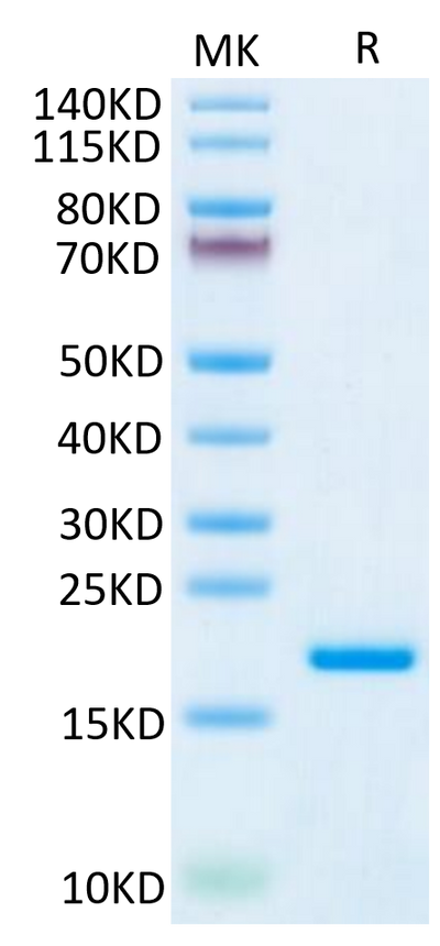 Human IL-20 on Tris-Bis PAGE under reduced condition. The purity is greater than 95%.