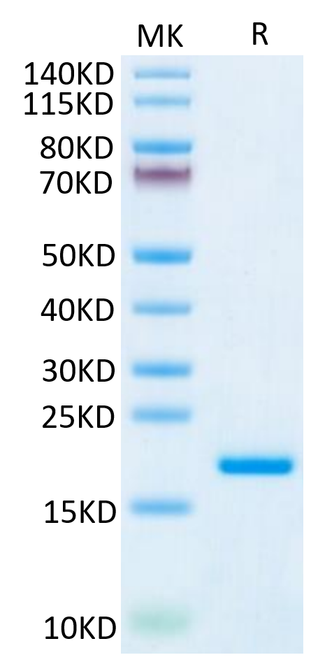 Human IL-20 on Tris-Bis PAGE under reduced condition. The purity is greater than 95%.