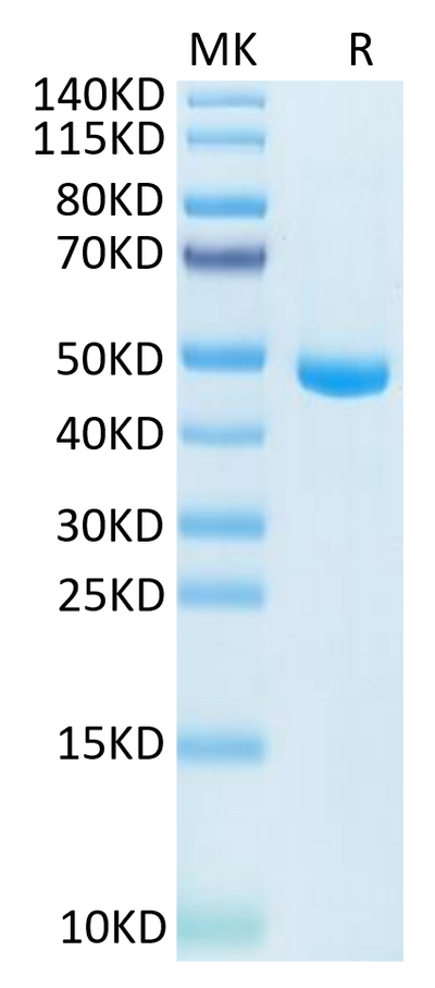 Human IL-20 on Tris-Bis PAGE under reduced condition. The purity is greater than 95%.