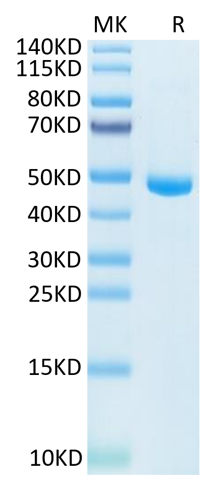 Human IL-20 on Tris-Bis PAGE under reduced condition. The purity is greater than 95%.