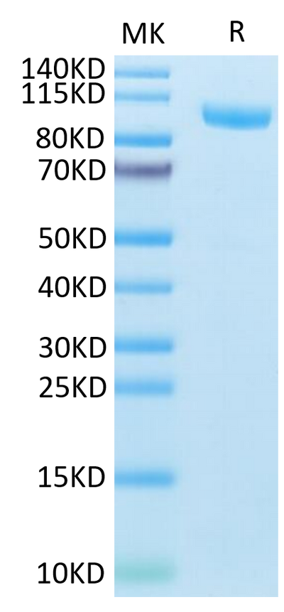 Mouse CDH17 on Tris-Bis PAGE under reduced condition. The purity is greater than 95%.