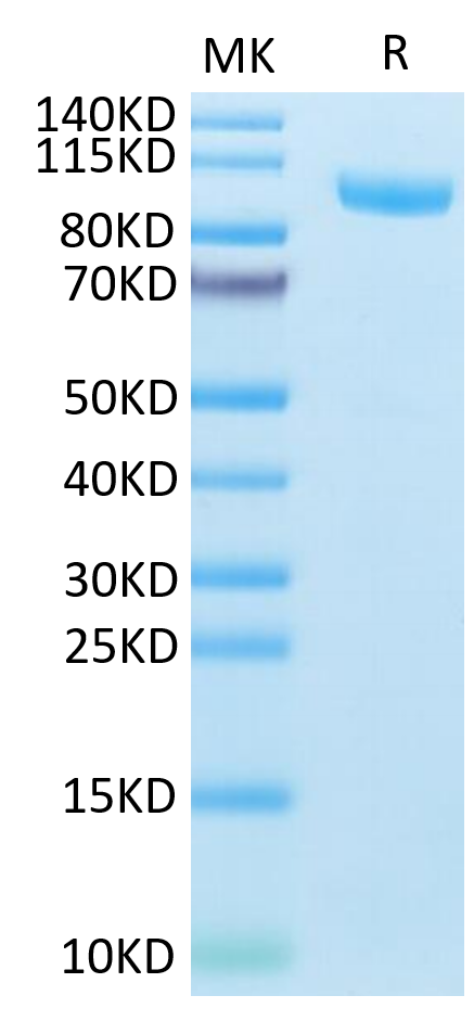 Mouse CDH17 on Tris-Bis PAGE under reduced condition. The purity is greater than 95%.