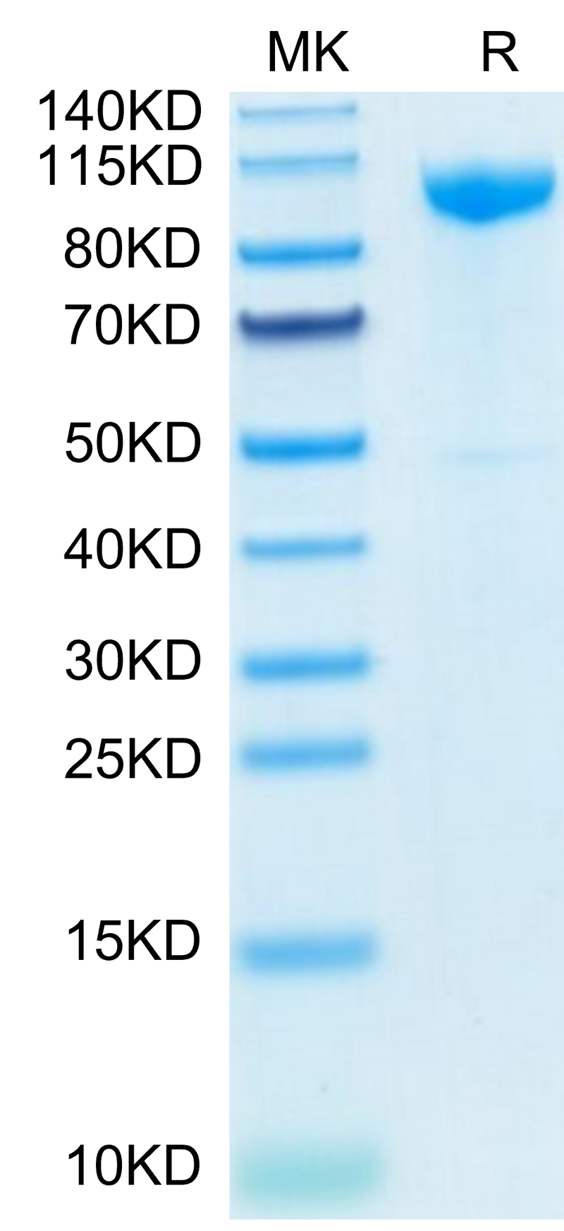 Human CDH17 on Tris-Bis PAGE under reduced condition. The purity is greater than 95%.