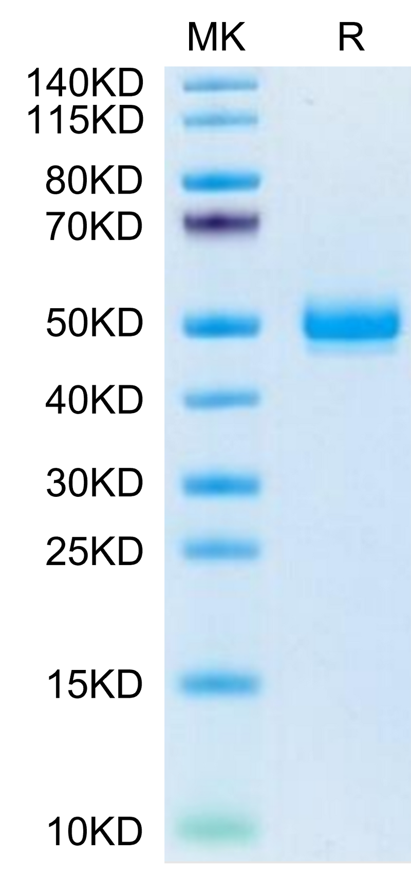 Mouse EPHA5 on Tris-Bis PAGE under reduced condition. The purity is greater than 95%.