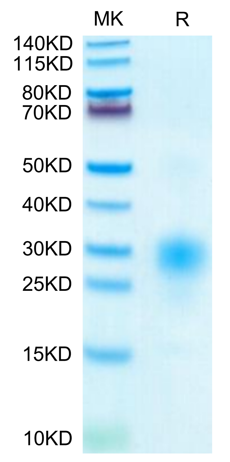 Human BST2 on Tris-Bis PAGE under reduced condition. The purity is greater than 95%.