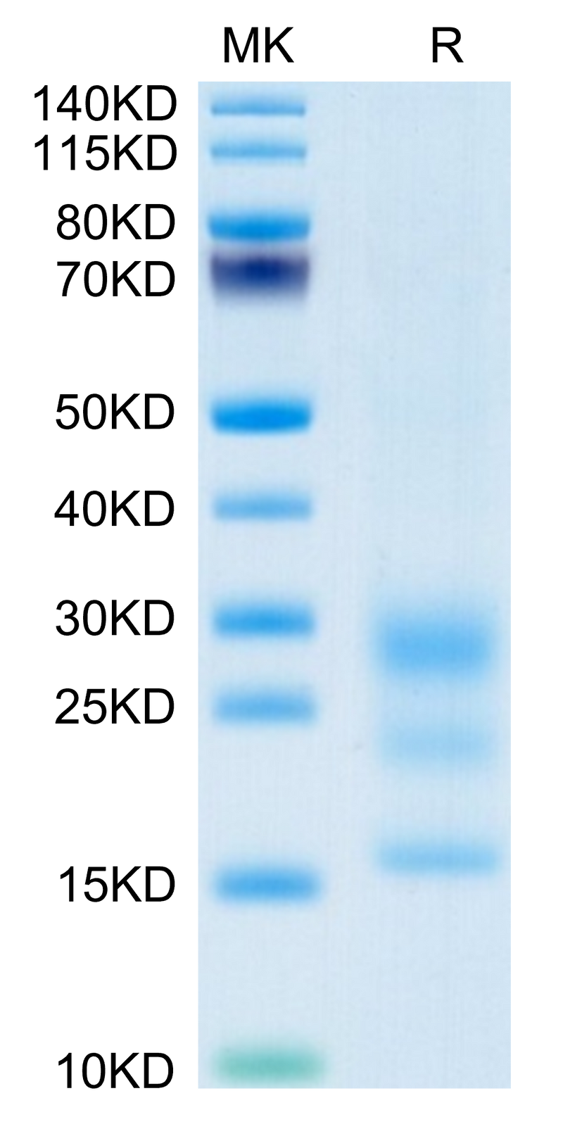 Mouse BST2 on Tris-Bis PAGE under reduced condition. The purity is greater than 95%.