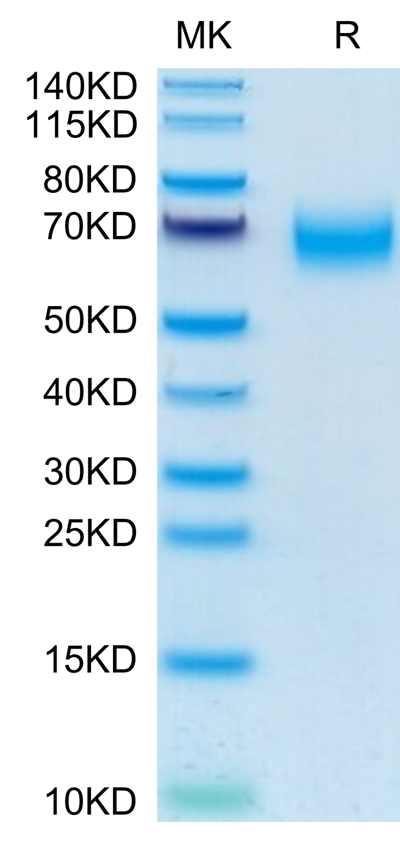 Human CD300A on Tris-Bis PAGE under reduced condition. The purity is greater than 95%.