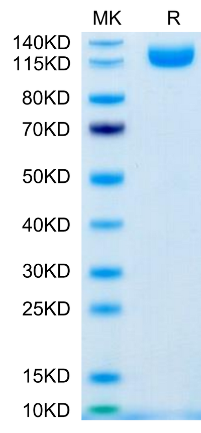 Human IL-31 RA-on Tris-Bis PAGE under reduced condition. The purity is greater than 95%.