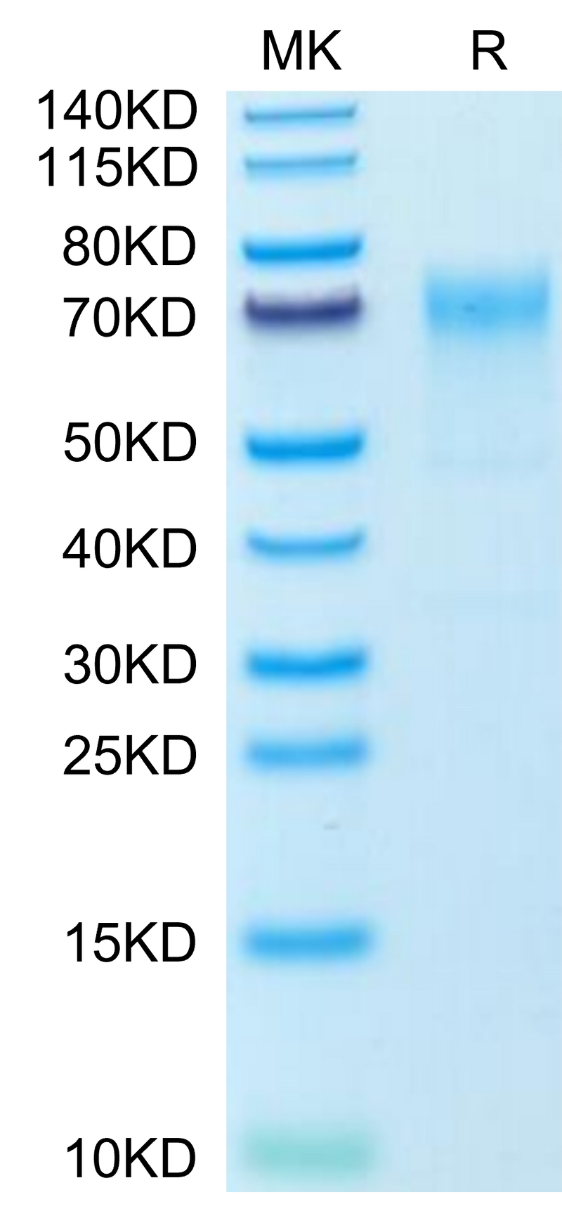 Mouse GPA on Tris-Bis PAGE under reduced condition. The purity is greater than 95%.