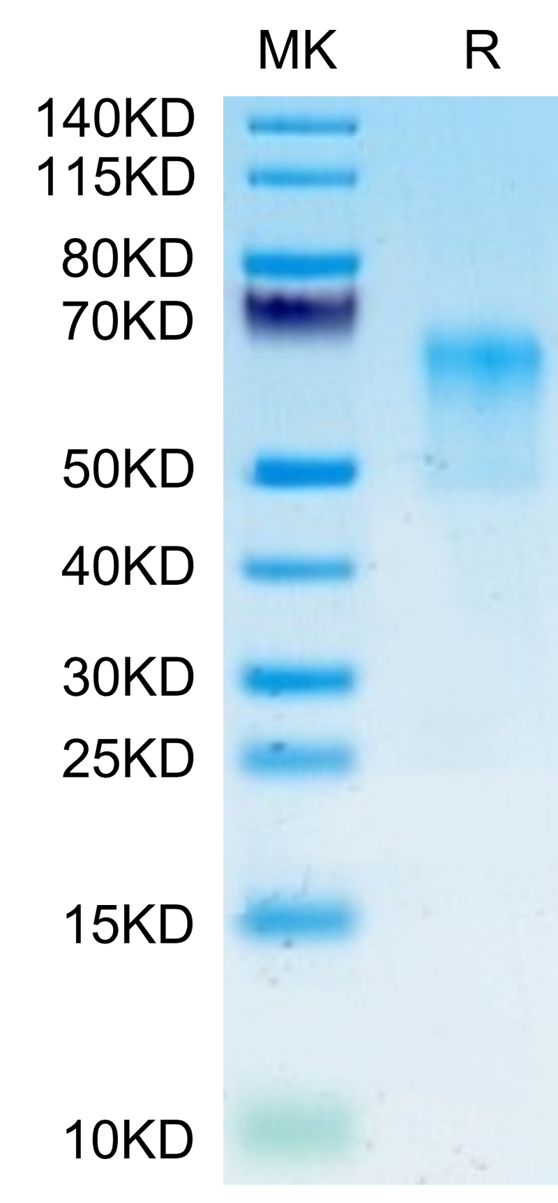 Human GPA on Tris-Bis PAGE under reduced condition. The purity is greater than 95%.