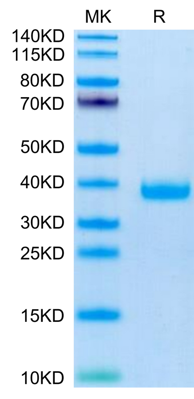 Mouse FSTL3 on Tris-Bis PAGE under reduced condition. The purity is greater than 95%.