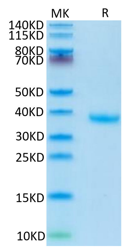 Human FSTL3 on Tris-Bis PAGE under reduced condition. The purity is greater than 95%.