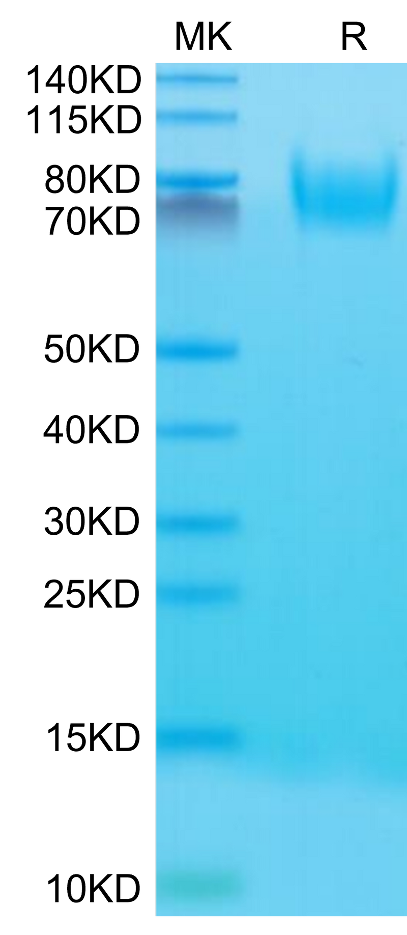 Mouse CD34 on Tris-Bis PAGE under reduced condition. The purity is greater than 95%.