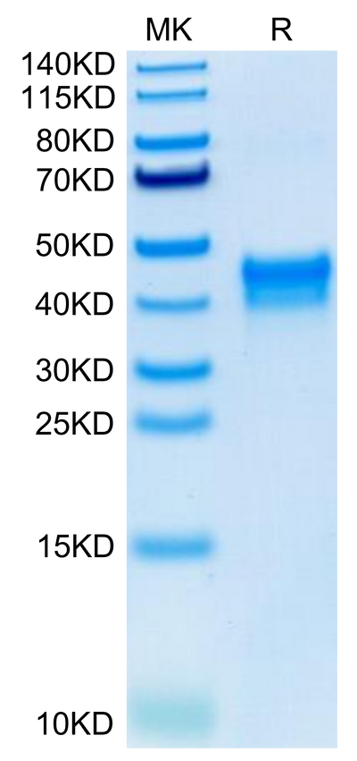 Human BST1 on Tris-Bis PAGE under reduced condition. The purity is greater than 95%.