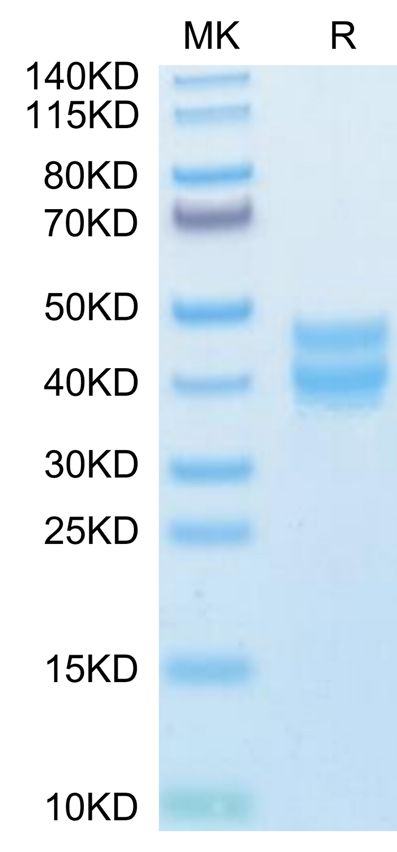 Mouse BST1 on Tris-Bis PAGE under reduced condition. The purity is greater than 95%.