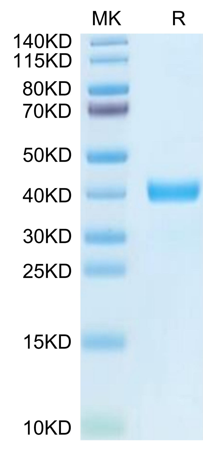 Human MFAP4 on Tris-Bis PAGE under reduced condition. The purity is greater than 95%.