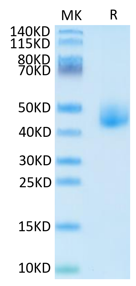 Human DLK1 on Tris-Bis PAGE under reduced condition. The purity is greater than 95%.