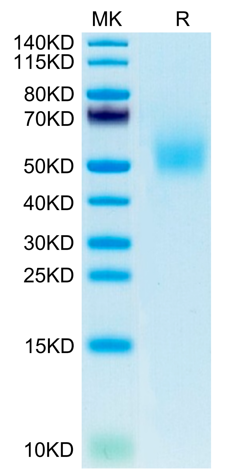 Mouse DLK1 on Tris-Bis PAGE under reduced condition. The purity is greater than 95%.