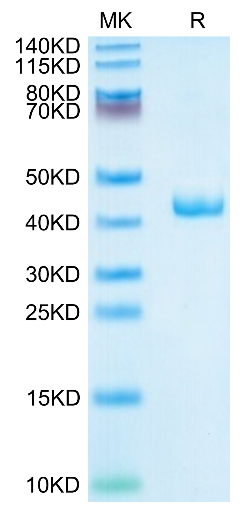 Human CXCL4 on Tris-Bis PAGE under reduced condition. The purity is greater than 95%.