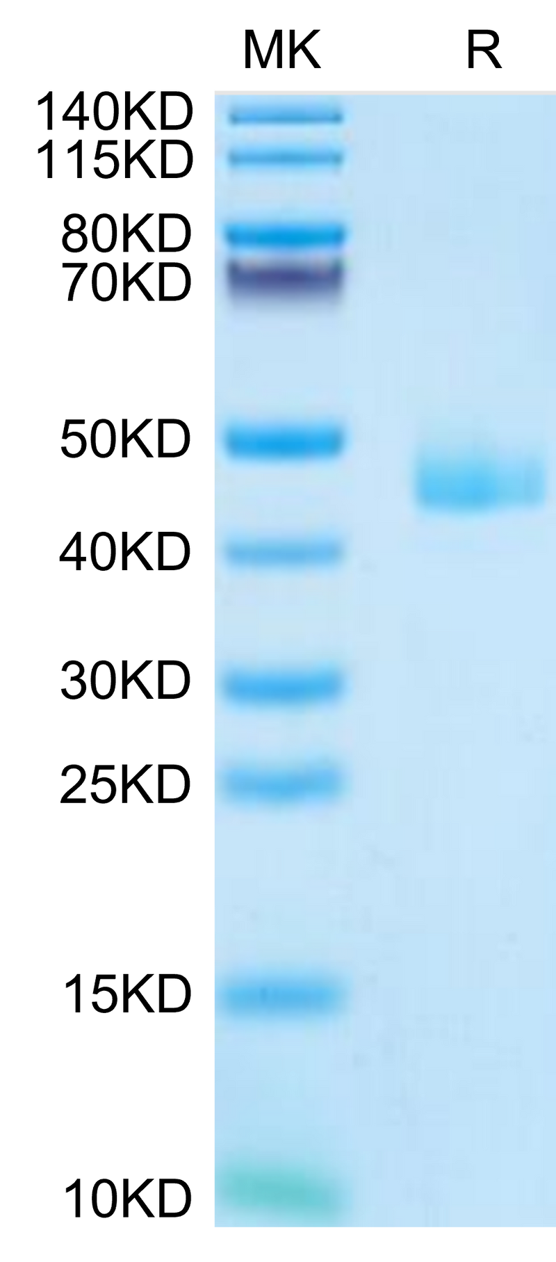 Mouse CCL24 on Tris-Bis PAGE under reduced condition. The purity is greater than 95%.