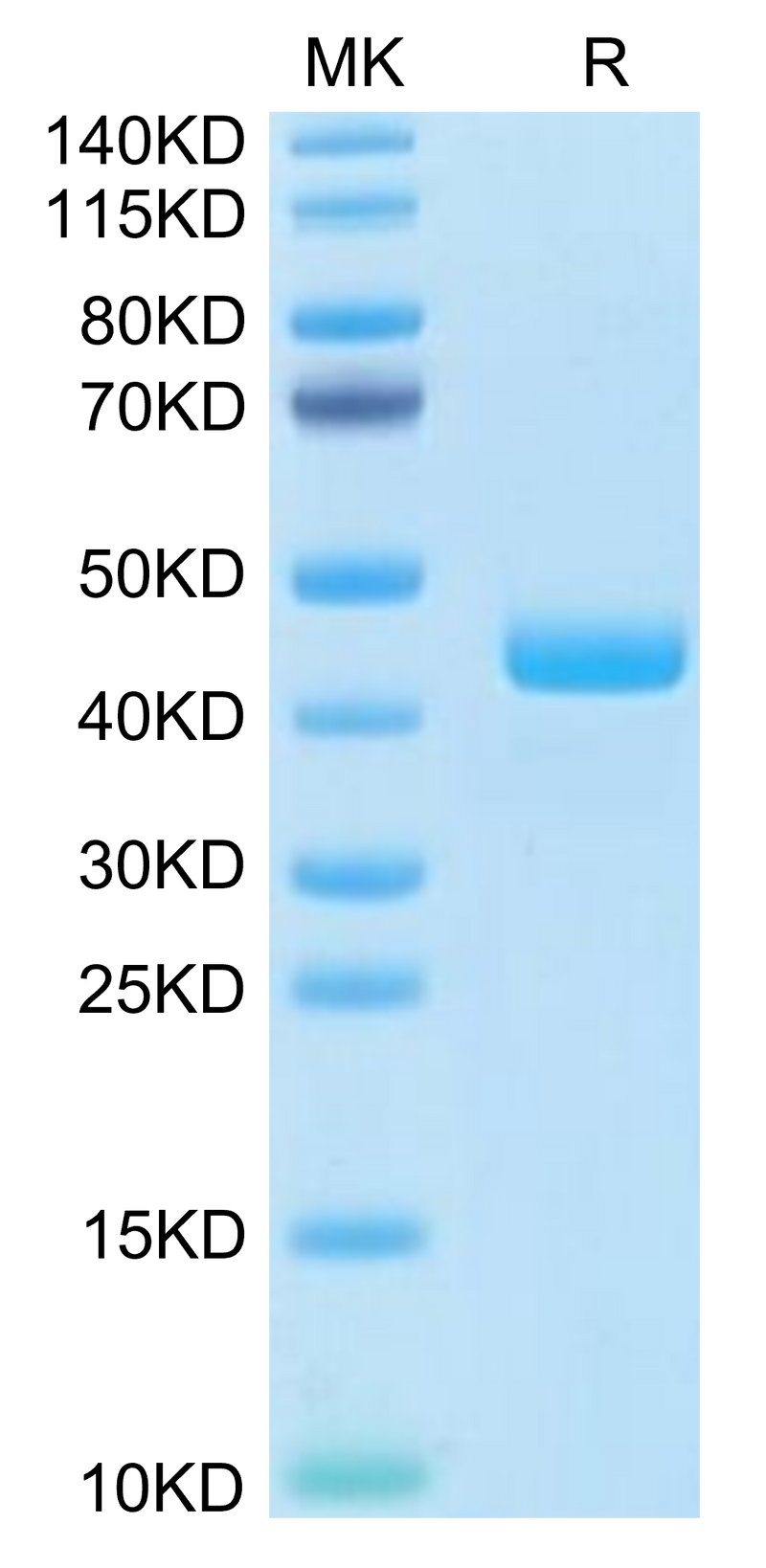 Human CCL24 on Tris-Bis PAGE under reduced condition. The purity is greater than 95%.