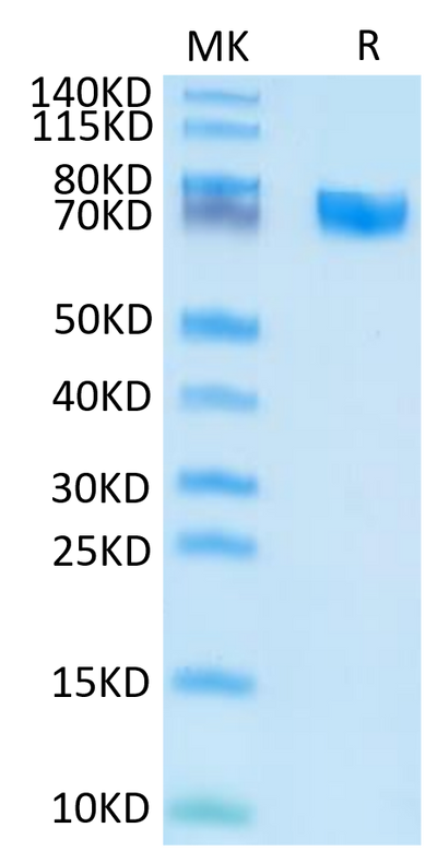 Human EPHA5 on Tris-Bis PAGE under reduced condition. The purity is greater than 95%.