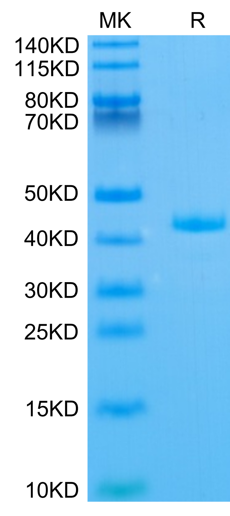 Human APOA2 on Tris-Bis PAGE under reduced condition. The purity is greater than 95%.