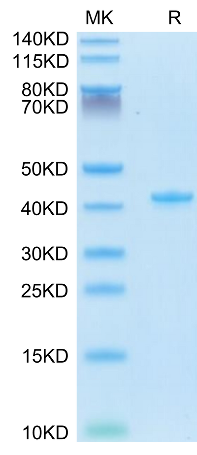 Mouse CCL5 on Tris-Bis PAGE under reduced condition. The purity is greater than 95%.