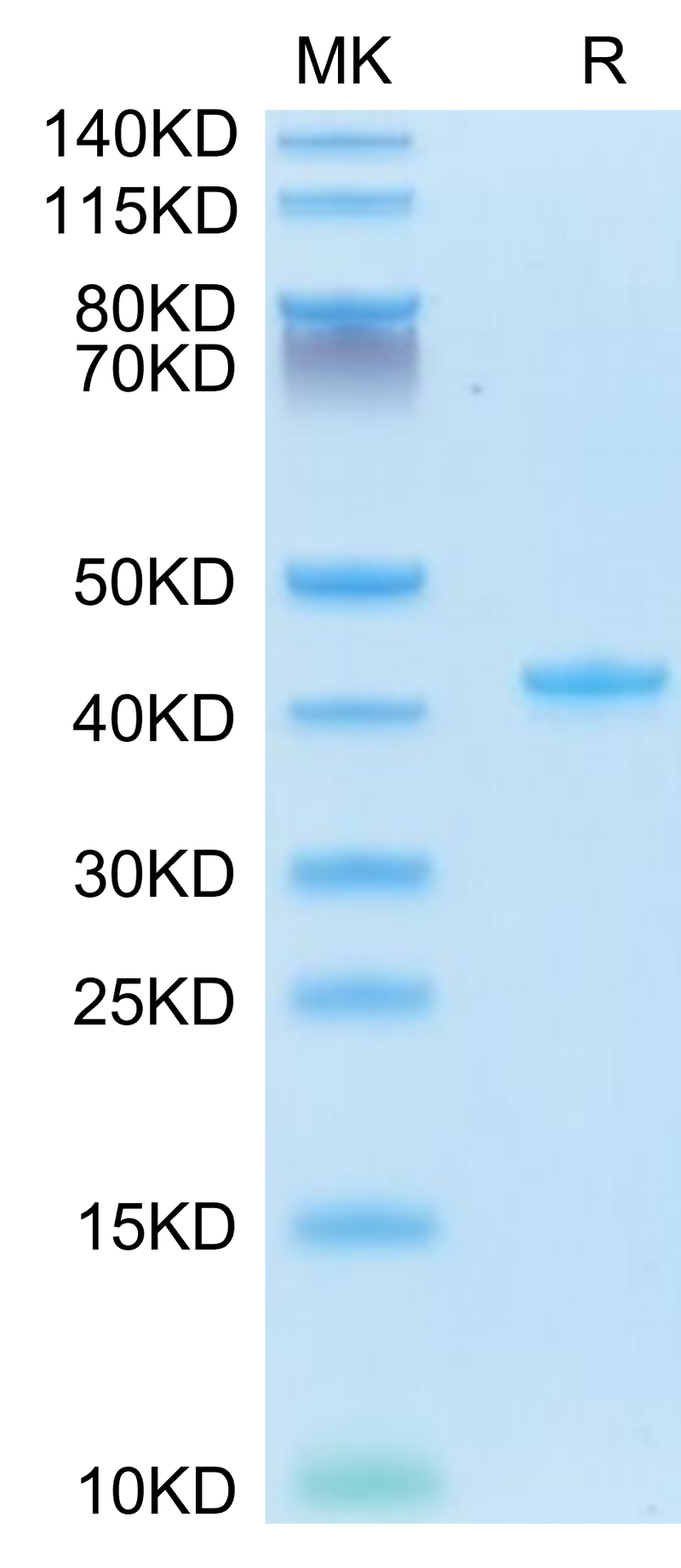 Mouse CCL5 on Tris-Bis PAGE under reduced condition. The purity is greater than 95%.