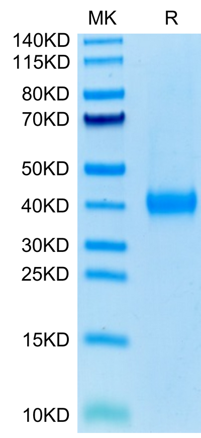 Human JAML on Tris-Bis PAGE under reduced condition. The purity is greater than 95%.