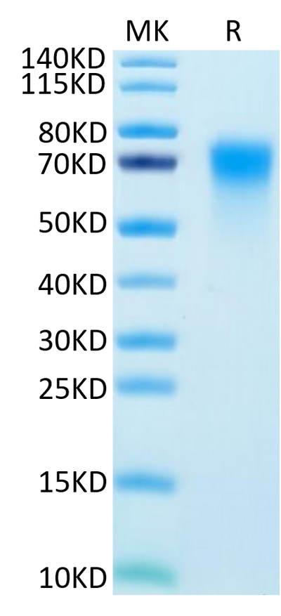 Human DR6 on Tris-Bis PAGE under reduced condition. The purity is greater than 95%.