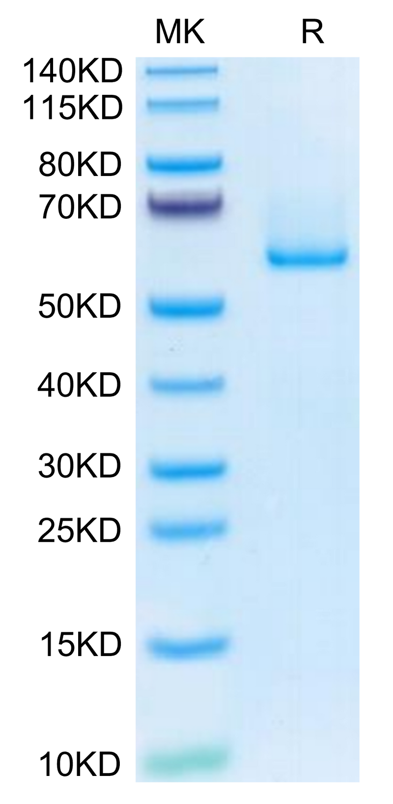 Human EFEMP1 on Tris-Bis PAGE under reduced condition. The purity is greater than 95%.