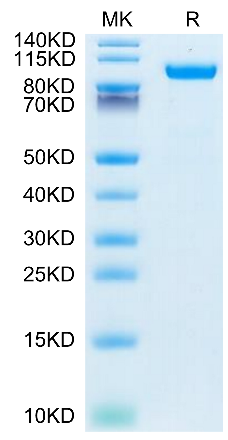 Human HGFA (pro form) on Tris-Bis PAGE under reduced condition. The purity is greater than 95%.