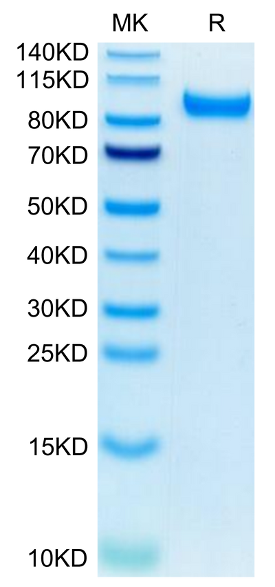 Mouse HGFA (pro form) on Tris-Bis PAGE under reduced condition. The purity is greater than 95%.