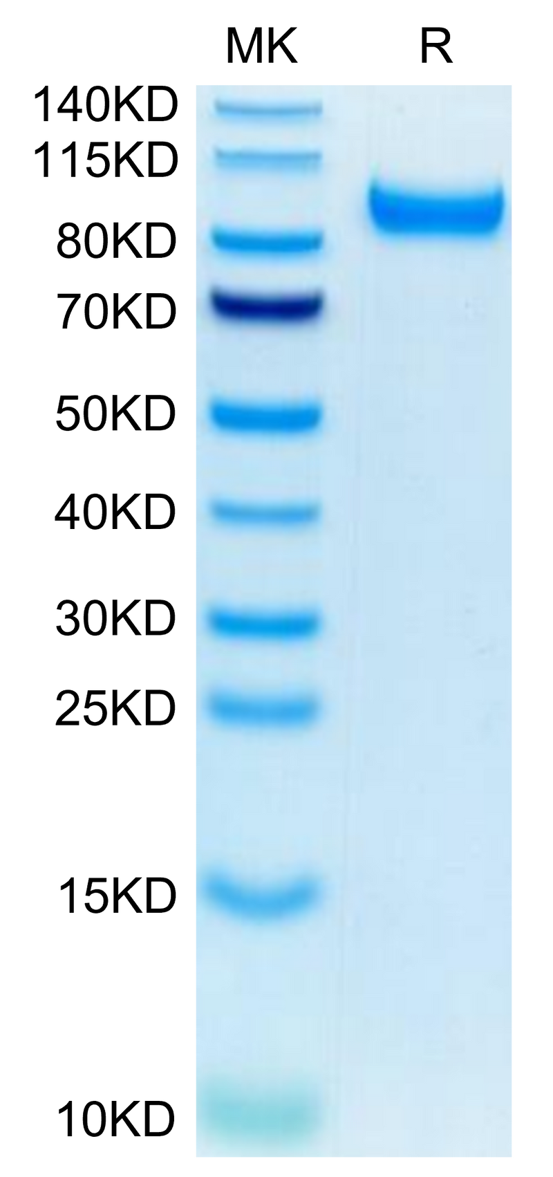 Mouse HGFA (pro form) on Tris-Bis PAGE under reduced condition. The purity is greater than 95%.