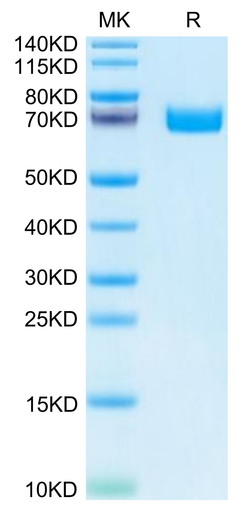 Human EPHB2 on Tris-Bis PAGE under reduced condition. The purity is greater than 95%.