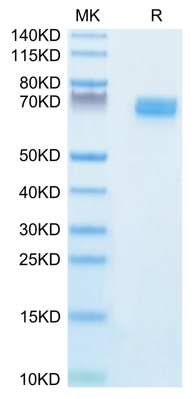 Human EPHB2 on Tris-Bis PAGE under reduced condition. The purity is greater than 95%.