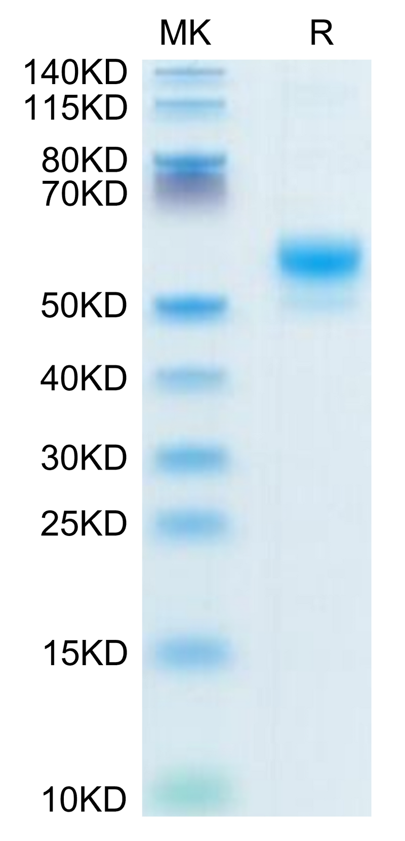 Human CD300LF on Tris-Bis PAGE under reduced condition. The purity is greater than 95%.