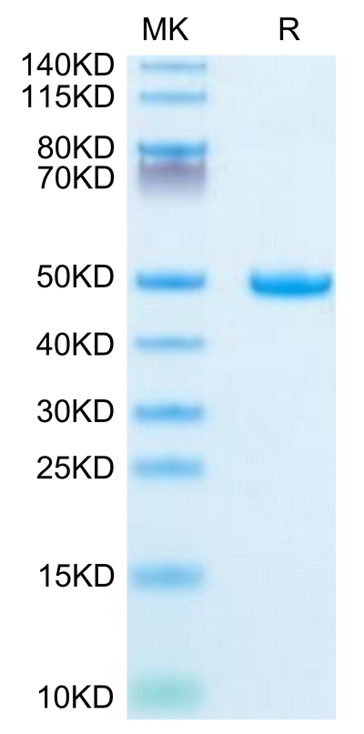 Mouse Galectin 1 on Tris-Bis PAGE under reduced condition. The purity is greater than 95%.