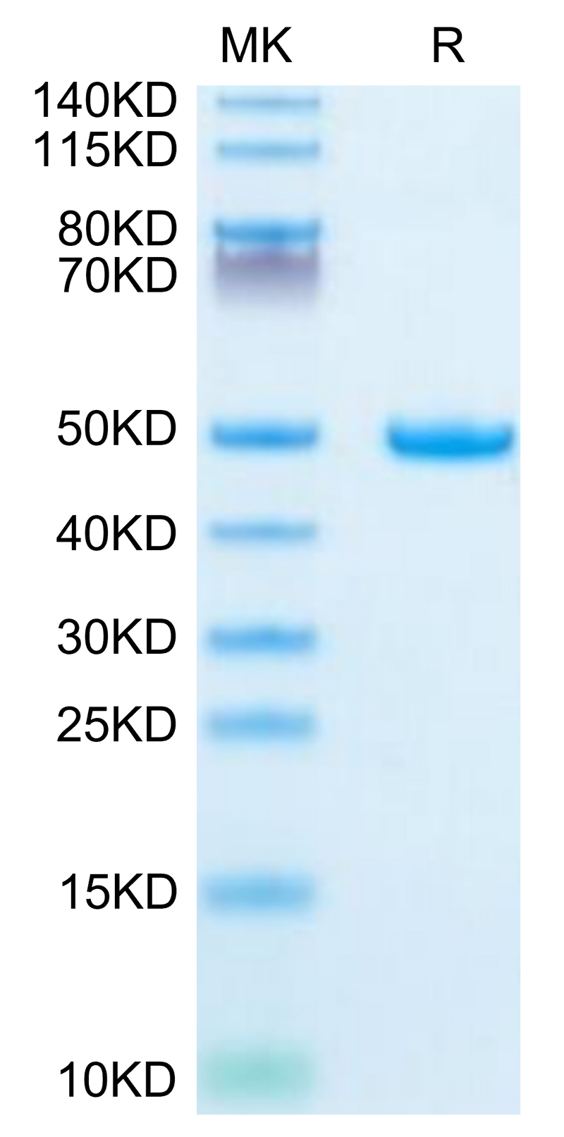 Mouse Galectin 1 on Tris-Bis PAGE under reduced condition. The purity is greater than 95%.