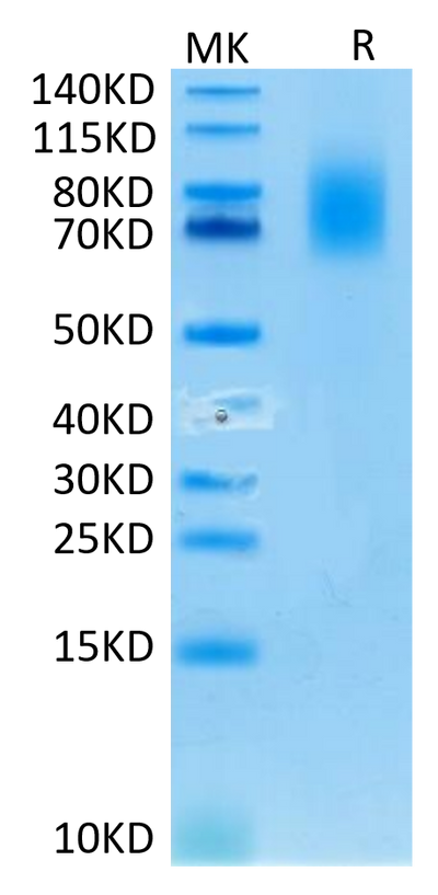 Human CD30 on Tris-Bis PAGE under reduced condition. The purity is greater than 95%.