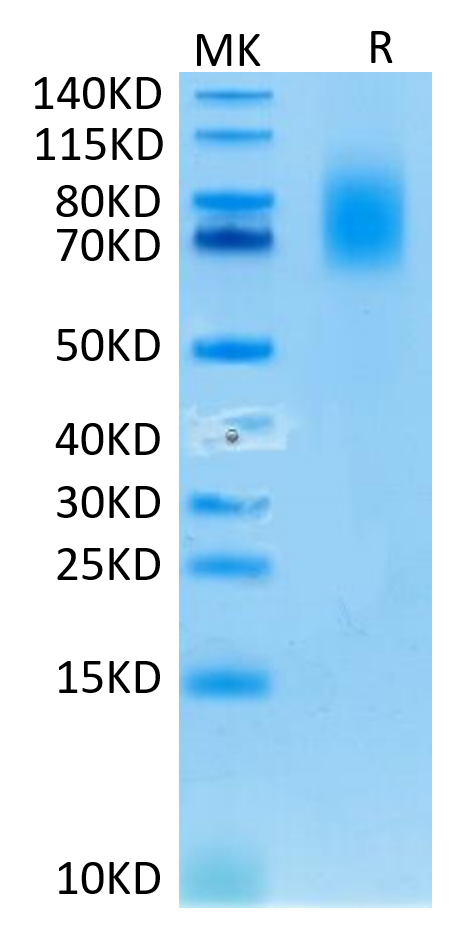 Human CD30 on Tris-Bis PAGE under reduced condition. The purity is greater than 95%.