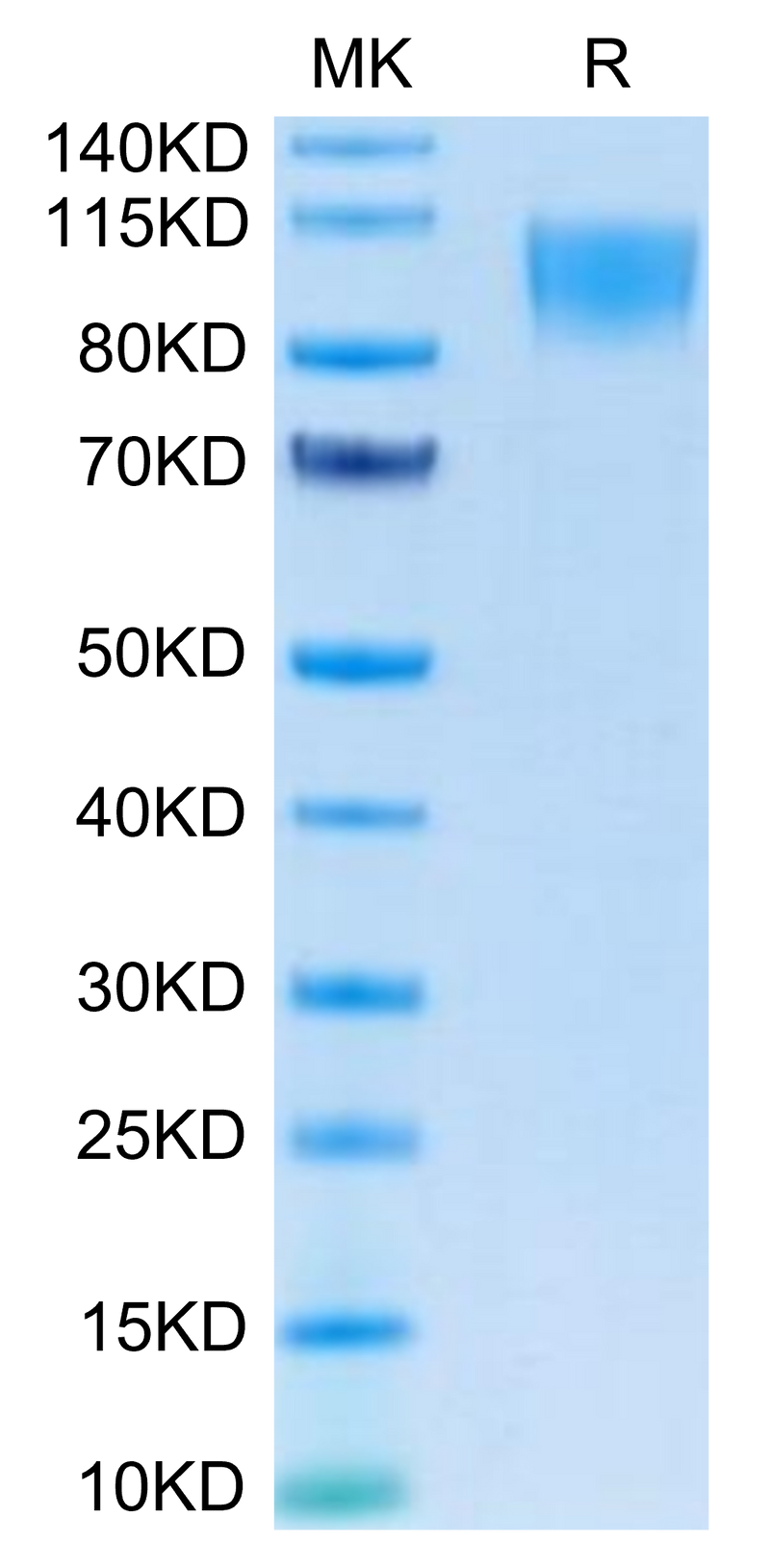 Human CD30 on Tris-Bis PAGE under reduced condition. The purity is greater than 95%.