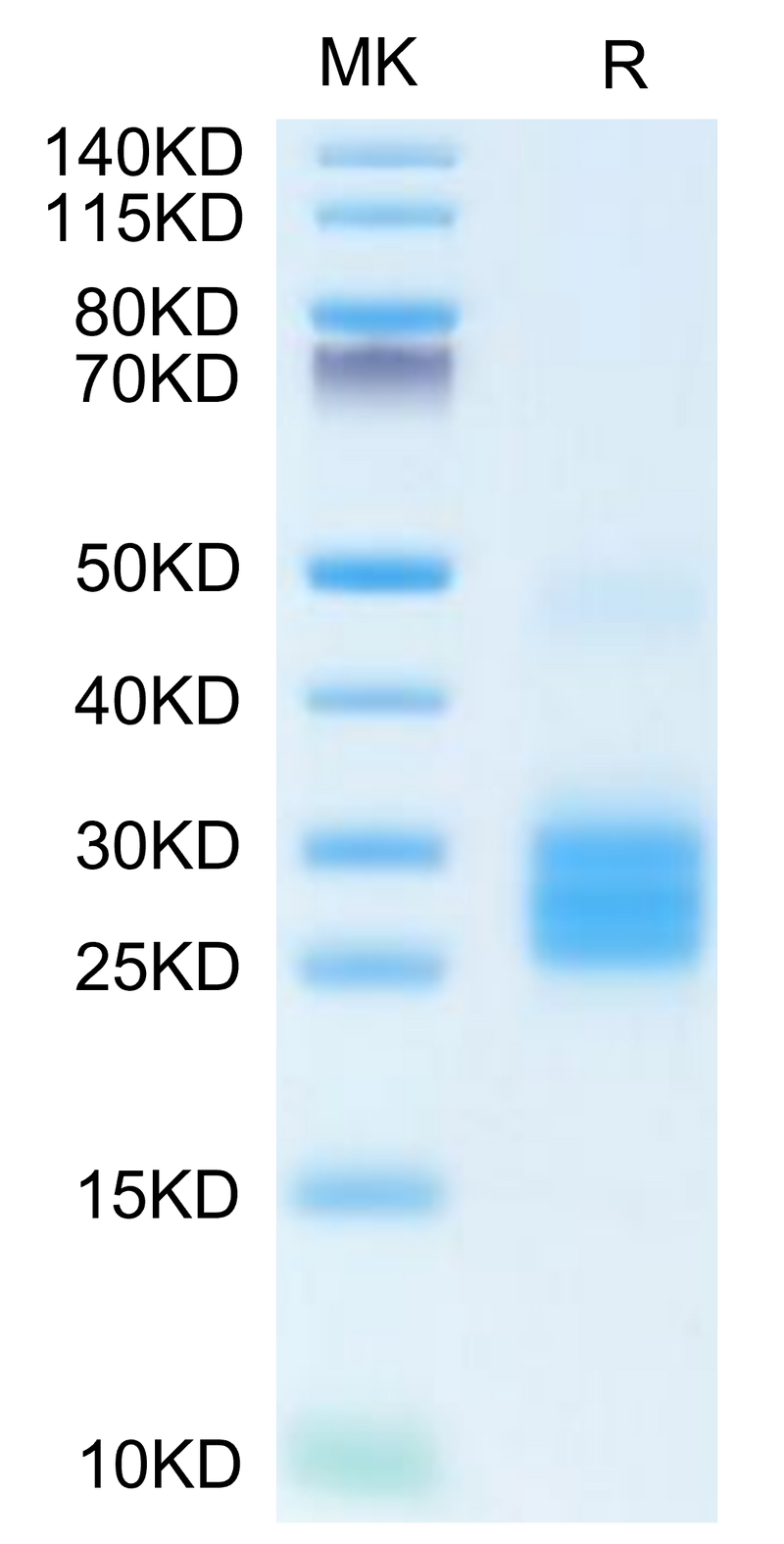 Human IL-25 on Tris-Bis PAGE under reduced condition. The purity is greater than 95%.