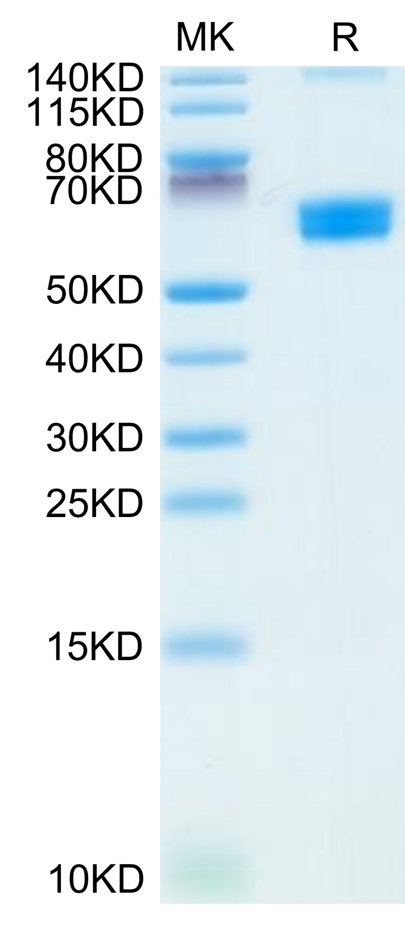 Mouse CLEC9A on Tris-Bis PAGE under reduced condition. The purity is greater than 95%.