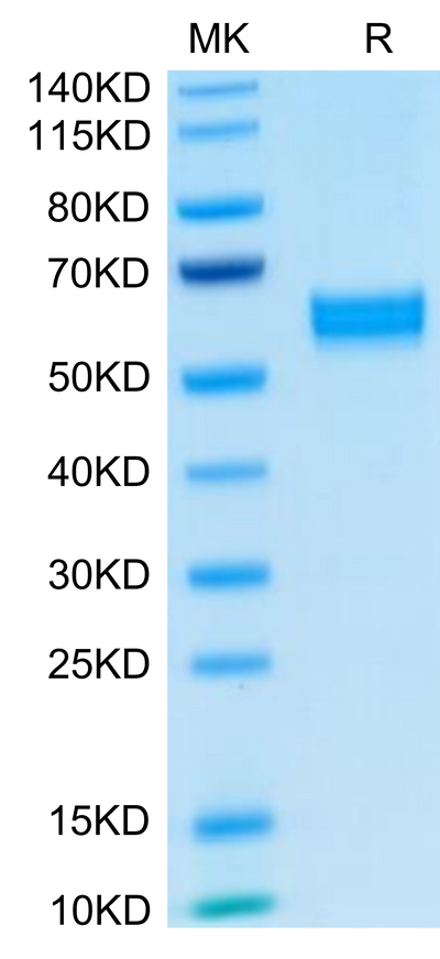 Human HGF on Tris-Bis PAGE under reduced condition. The purity is greater than 95%.