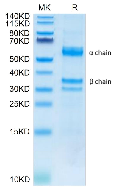 Human HGF on Tris-Bis PAGE under reduced condition. The purity is greater than 95%.