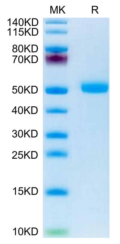 Human FSHB on Tris-Bis PAGE under reduced condition. The purity is greater than 95%.