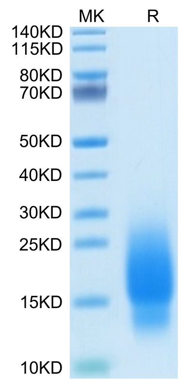 Human GIP on Tris-Bis PAGE under reduced condition. The purity is greater than 95%.