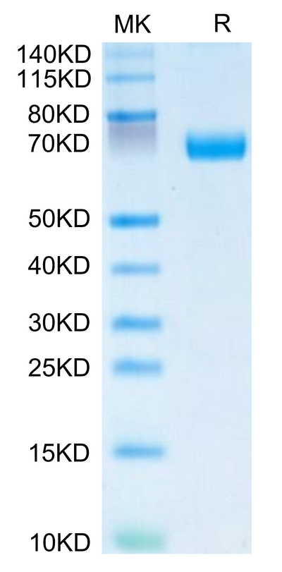 Human IL-20RA on Tris-Bis PAGE under reduced condition. The purity is greater than 95%.